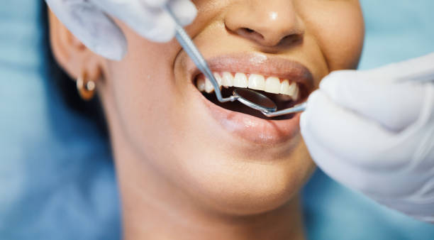 Best Emergency Dentist for Lost Fillings or Crowns in Nashville, MI