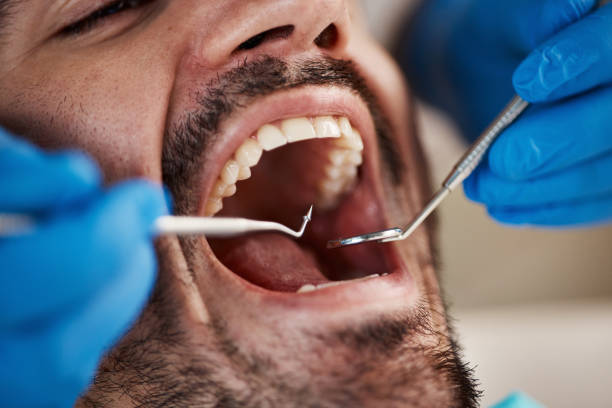 Best Emergency Dental Services for Seniors in Nashville, MI